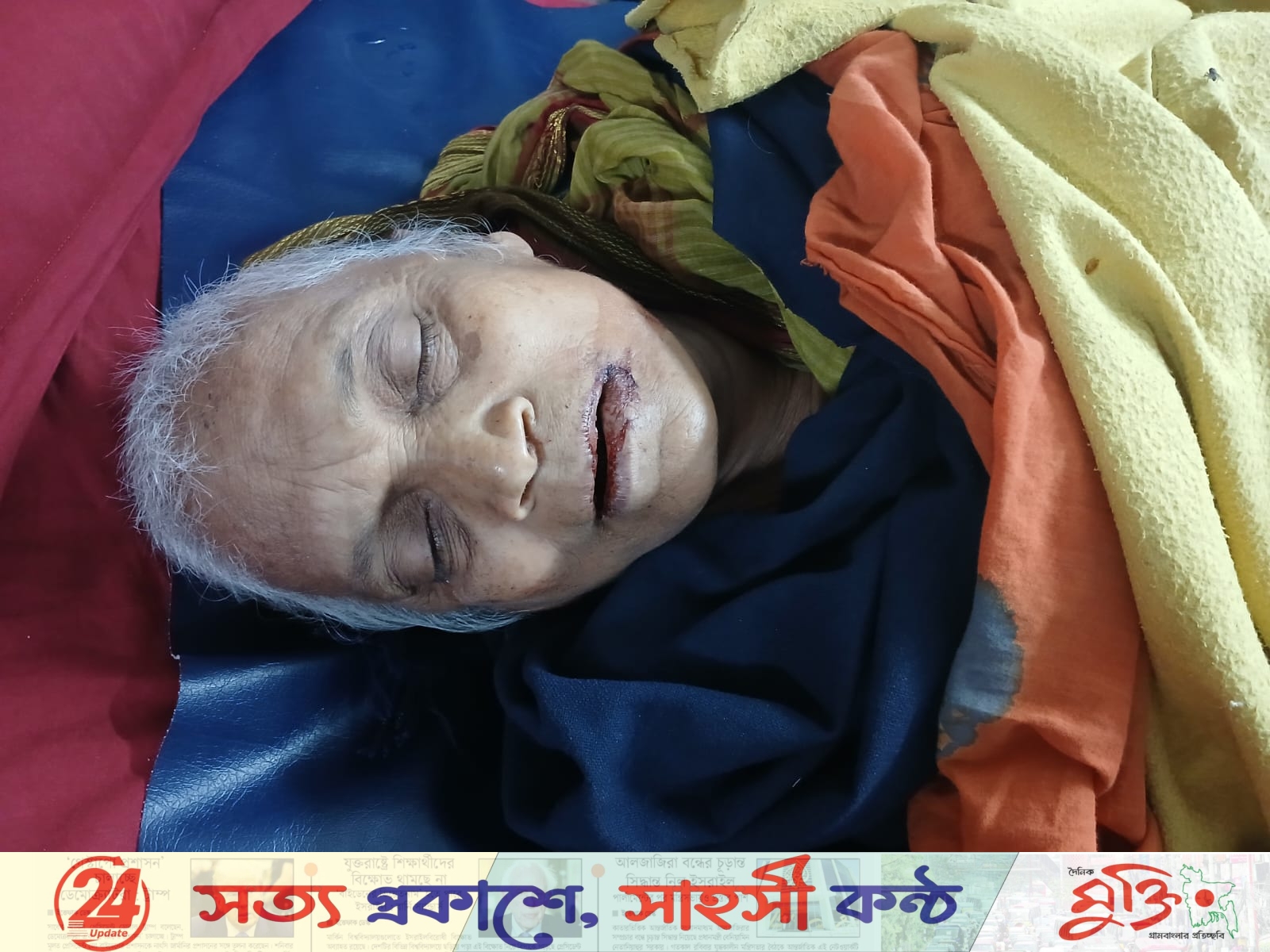 বড়াইগ্রামে গাড়ির ধাক্কায় ভিক্ষুক নিহত